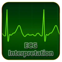 ECG Interpretation